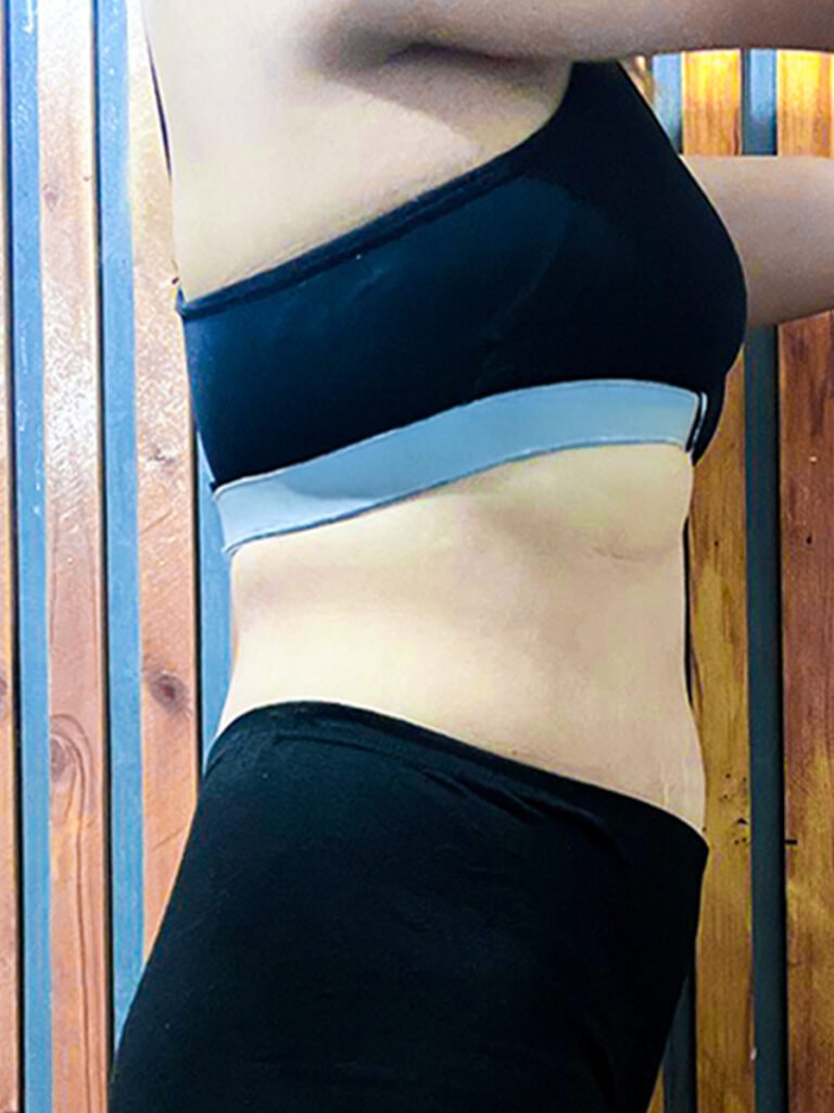 after weight loss results using GLP-1 peptide therapy in the Philippines - Cheska